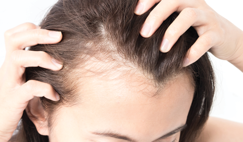 Does acupuncture help with hair loss Regrowz