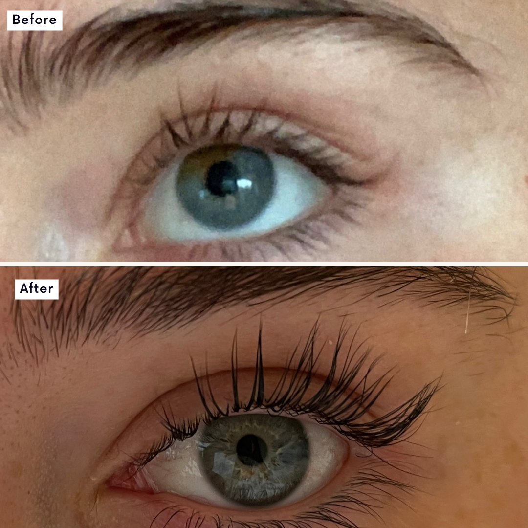Miracle Brow & Lash Growth Serum