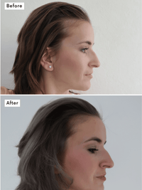 Miracle Hair Thickening Shampoo view 2