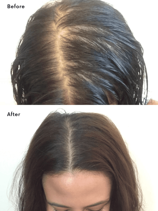 Miracle Hair Oil