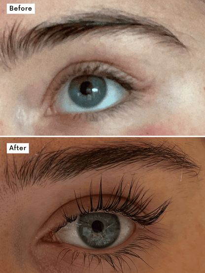 Miracle Brow & Lash Growth Serum