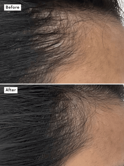 Hair Growth Supplement