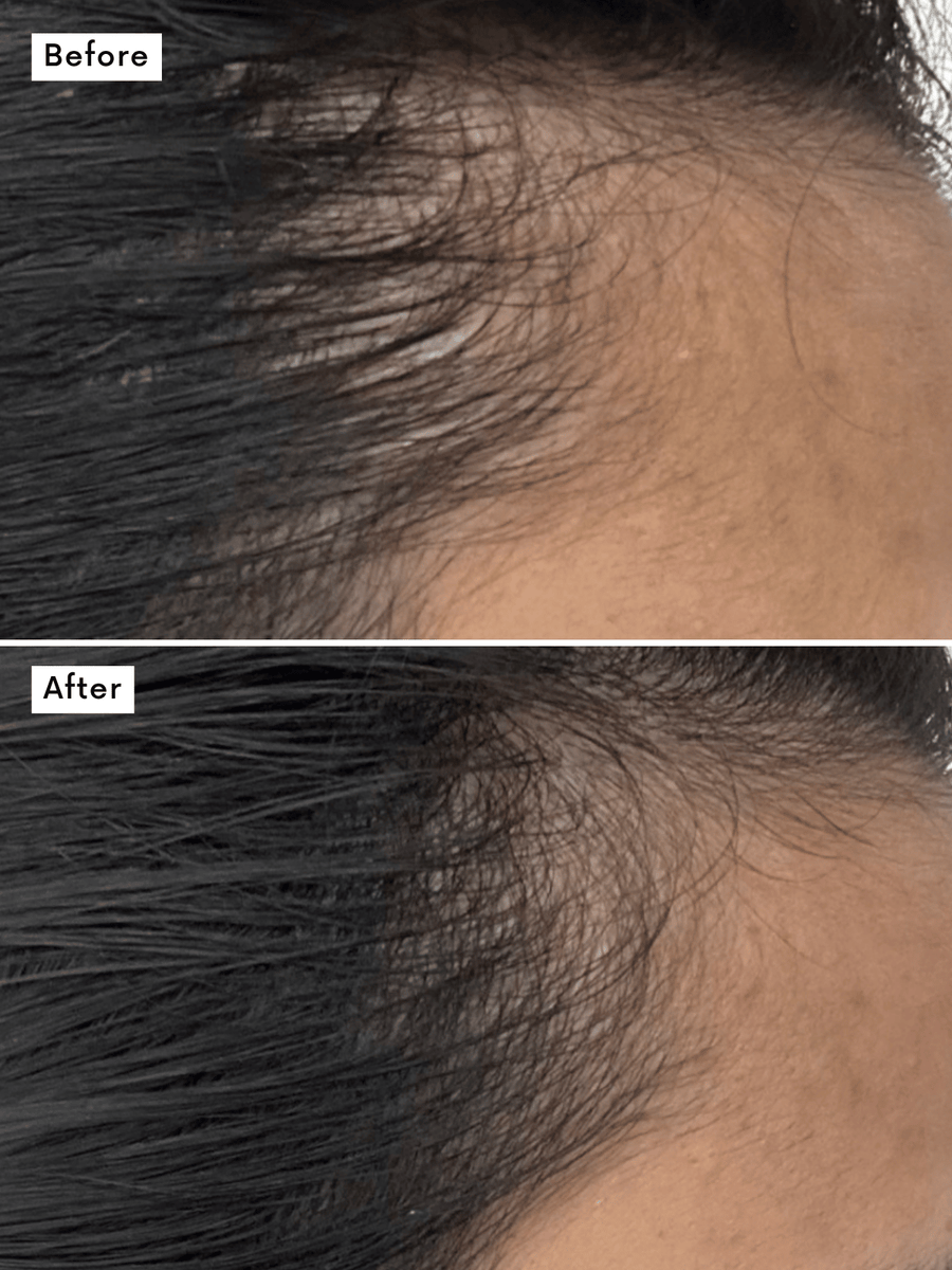 Hair Growth Supplement view 2